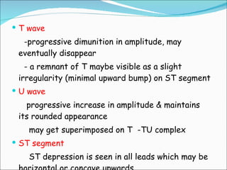T wave -progressive dimunition in amplitude, may eventually disappear - a remnant of T maybe visible as a slight irregularity (minimal upward bump) on ST segment U wave progressive increase in amplitude & maintains its rounded appearance may get superimposed on T  -TU complex ST segment ST depression is seen in all leads which may be horizontal or concave upwards 