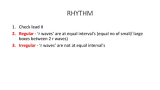 RHYTHM
1. Check lead II
2. Regular - ‘r waves’ are at equal interval's (equal no of small/ large
boxes between 2 r waves)
3. Irregular - ‘r waves’ are not at equal interval's
 