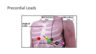 Precordial Leads
Adapted from: www.numed.co.uk/electrodepl.html
 