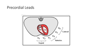 Precordial Leads
 