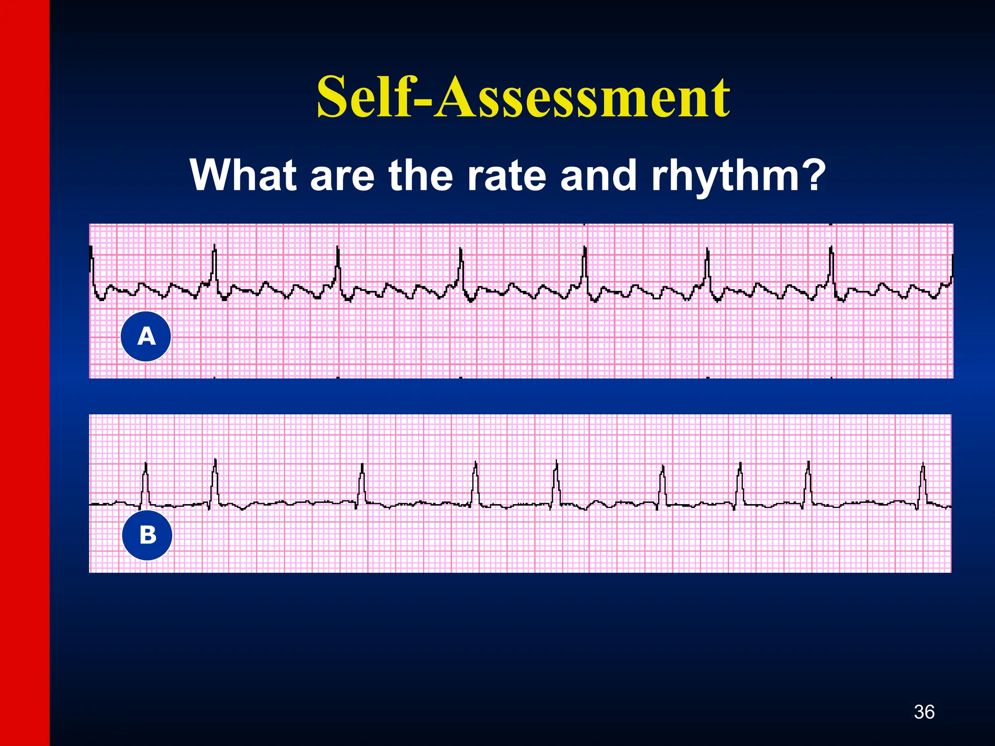 ECG-Slide-Set.pptx the basics of ECG reading | PPT