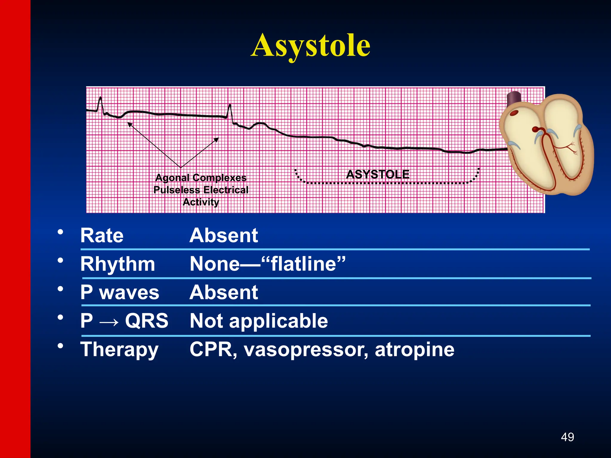 ECG-Slide-Set.pptx the basics of ECG reading | PPTX