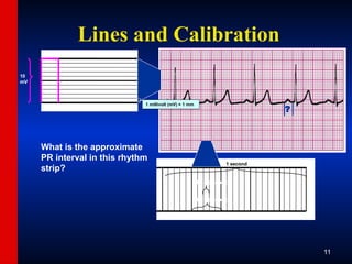 ECG-Slide-Set.pptx the basics of ECG reading | PPTX