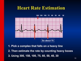 ECG-Slide-Set.pptx the basics of ECG reading | PPTX