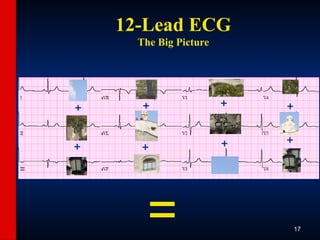 ECG-Slide-Set.pptx the basics of ECG reading | PPTX