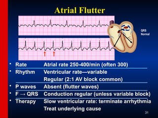 ECG-Slide-Set.pptx the basics of ECG reading | PPTX