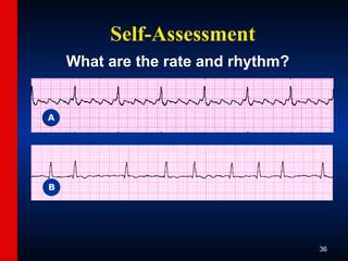 ECG-Slide-Set.pptx the basics of ECG reading | PPTX