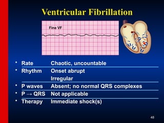 Normal Vf ECG-Slide-Set.pptx the basics of ECG reading | PPTX
