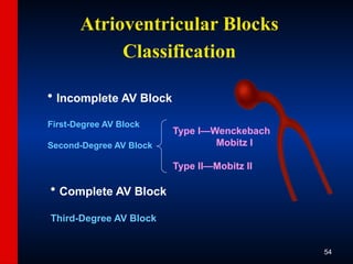 ECG-Slide-Set.pptx the basics of ECG reading | PPTX