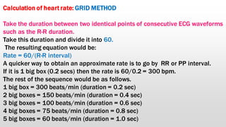 Basics of electrocardiogram | PDF