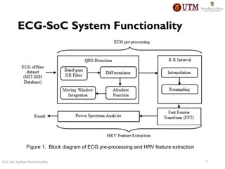 FPGA Design and Implementation of Electrocardiogram Biomedical Embedded ...