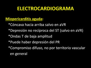 ELECTROCARDIOGRAMA
Miopericarditis aguda:
*Cóncava hacia arriba salvo en aVR
*Depresión no recíproca del ST (salvo en aVR)
*Ondas T de baja amplitud
*Puede haber depresión del PR
*Compromiso difuso, no por territorio vascular
en general
 