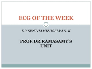 DR.SENTHAMIZHSELVAN. K PROF.DR.RAMASAMY’S UNIT ECG OF THE WEEK 