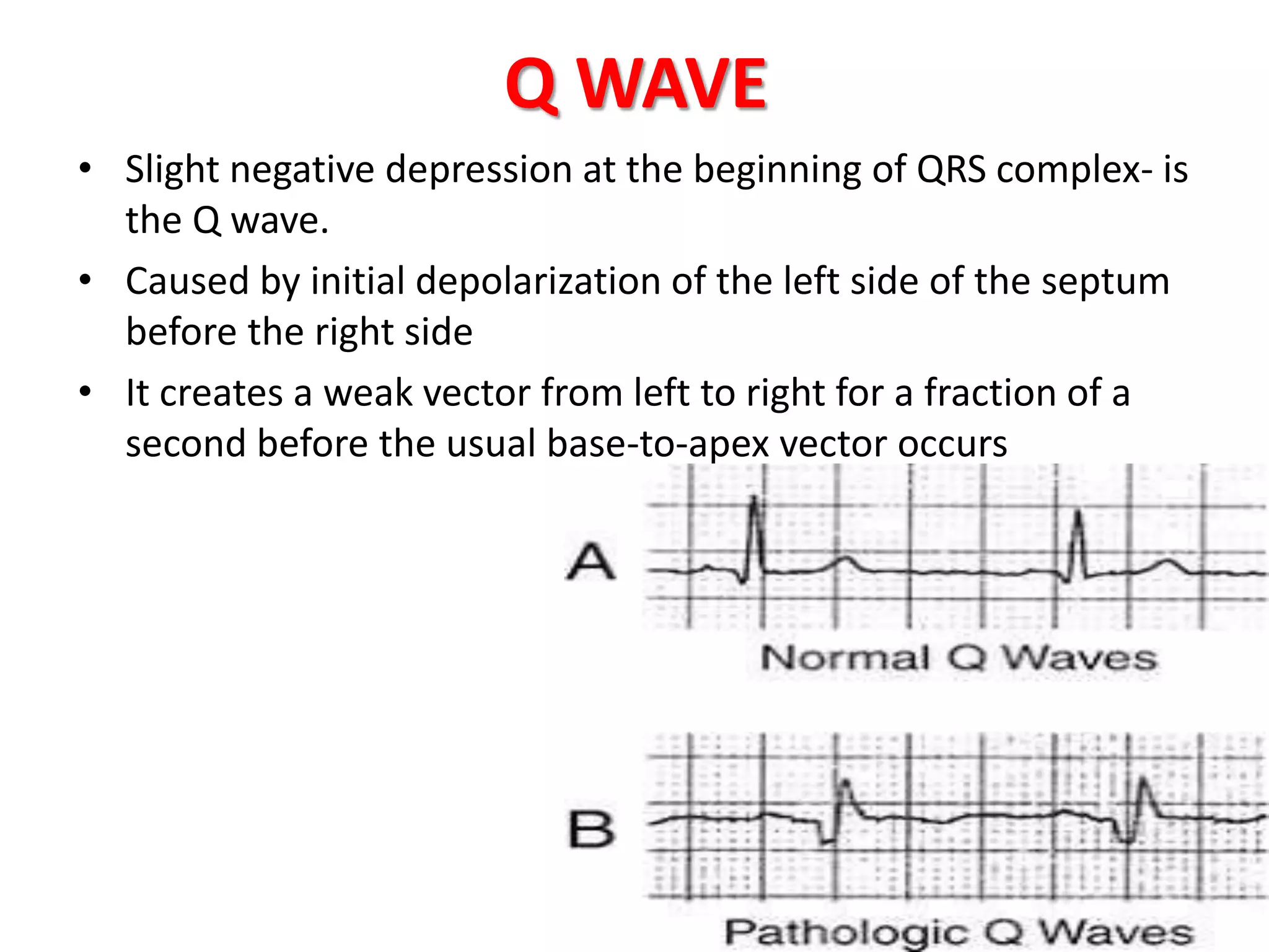 Ecg- Vector Analysis | PPTX