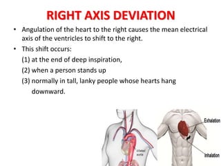Ecg- Vector Analysis | PPTX