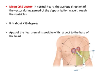 Vector Examples Ecg Ecg- Vector Analysis | PPTX