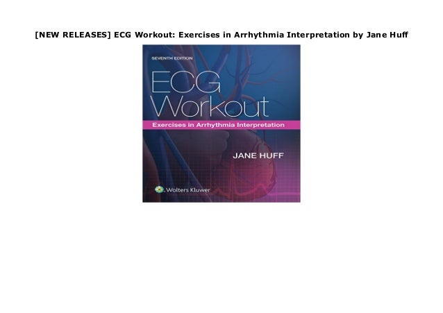 42 Simple Ecg workout exercises in arrhythmia interpretation 7th edition pdf for Girls