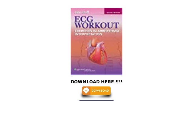 ECG Workout Exercises in Arrhythmia Interpretation Best