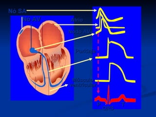 Nó SA
    Nó AV   Atrio

            Nodo AV


              Purkinje




             Músculo
            ventricular


                          P         T
                              QRS
 