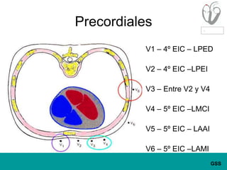 PrecordialesV1 – 4º EIC – LPEDV2 – 4º EIC –LPEIV3 – Entre V2 y V4V4 – 5º EIC –LMCIV5 – 5º EIC – LAAIV6 – 5º EIC –LAMI
