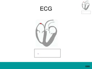 ECG