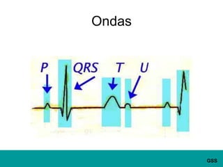 Ondas