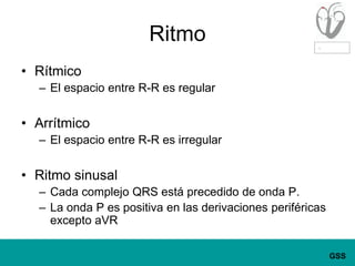 RitmoRítmicoEl espacio entre R-R es regularArrítmicoEl espacio entre R-R es irregularRitmo sinusalCada complejo QRS está precedido de onda P.La onda P es positiva en las derivaciones periféricas excepto aVR