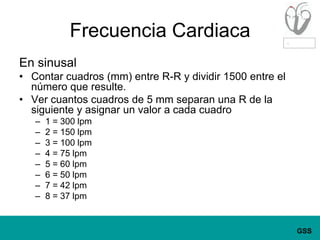 Frecuencia CardiacaEn sinusalContar cuadros (mm) entre R-R y dividir 1500 entre el número que resulte.Ver cuantos cuadros de 5 mm separan una R de la siguiente y asignar un valor a cada cuadro1 = 300 lpm2 = 150 lpm3 = 100 lpm4 = 75 lpm5 = 60 lpm6 = 50 lpm7 = 42 lpm8 = 37 lpm
