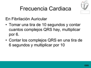 Frecuencia CardiacaEn Fibrilación AuricularTomar una tira de 10 segundos y contar cuantos complejos QRS hay, multiplicar por 6.Contar los complejos QRS en una tira de 6 segundos y multiplicar por 10