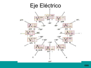 Eje Eléctrico