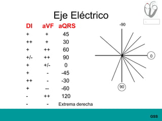 Eje EléctricoDI	aVFaQRS+		  +	   45++	  +	   30+		 ++	   60+/-	 ++	   90+		 +/-	    0+		   -	  -45++	   -	  -30+		  --	  -60-		 ++	  120-		   -	Extrema derecha-90090