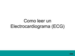 Como leer unElectrocardiograma (ECG)
