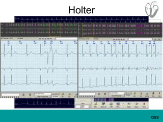 Holter