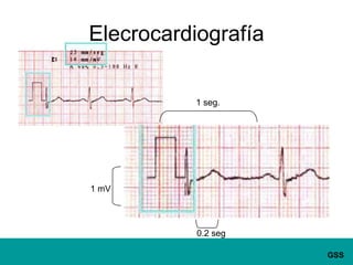 1 seg.1 mV0.2 segElecrocardiografía