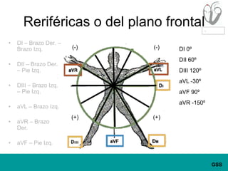 Reriféricas o del plano frontalDI – Brazo Der. – Brazo Izq.DII – Brazo Der. – Pie Izq.DIII – Brazo Izq. – Pie Izq.aVL – Brazo Izq.aVR – Brazo Der.aVF – Pie Izq.(-)(-)DI 0ºDII 60ºDIII 120ºaVL -30ºaVF 90ºaVR -150º(+)(+)