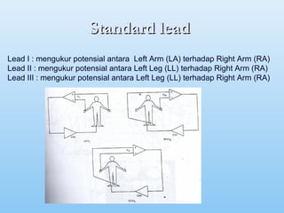 Standard leadStandard lead
Lead I : mengukur potensial antara Left Arm (LA) terhadap Right Arm (RA)
Lead II : mengukur potensial antara Left Leg (LL) terhadap Right Arm (RA)
Lead III : mengukur potensial antara Left Leg (LL) terhadap Right Arm (RA)
 