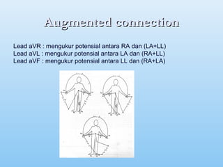 Augmented connectionAugmented connection
Lead aVR : mengukur potensial antara RA dan (LA+LL)
Lead aVL : mengukur potensial antara LA dan (RA+LL)
Lead aVF : mengukur potensial antara LL dan (RA+LA)
 