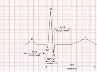 ECG1.pdf