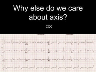 Why else do we care
about axis?
CQC
 
