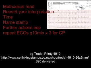 Methodical read
Record your interpretation
Time
Name stamp
Further actions esp
repeat ECGs q10min x 3 for CP
eg Trodat Printy 4910
http://www.selfinkingstamps.co.nz/shop/trodat-4910-26x9mm/
$20 delivered
 
