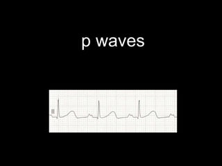 p waves
 