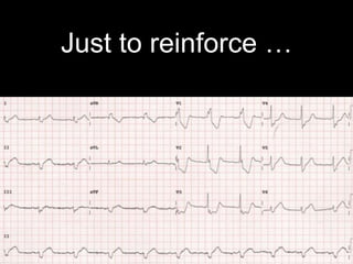 Just to reinforce …
 