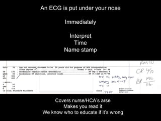 An ECG is put under your nose
Immediately
Interpret
Time
Name stamp
Covers nurse/HCA’s arse
Makes you read it
We know who to educate if it’s wrong
 