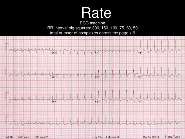 Ecg 101 With Answers Ecg 101 With Answers