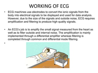 WORKING OF ECG
• ECG machines use electrodes to convert the ionic signals from the
body into electrical signals to be displayed and used for data analysis.
However, due to the size of the signals and outside noise, ECG requires
amplification and filtering to produce high quality signals.
• An ECG’s job is to amplify the small signal measured from the heart as
well as to filter outside and internal noise. The amplification is mainly
implemented through a differential amplifier whereas filtering is
completed through common and differential mode filtering.
•
 