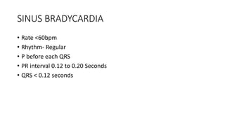 SINUS BRADYCARDIA
• Rate <60bpm
• Rhythm- Regular
• P before each QRS
• PR interval 0.12 to 0.20 Seconds
• QRS < 0.12 seconds
 