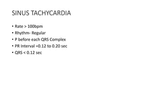 SINUS TACHYCARDIA
• Rate > 100bpm
• Rhythm- Regular
• P before each QRS Complex
• PR Interval =0.12 to 0.20 sec
• QRS < 0.12 sec
 