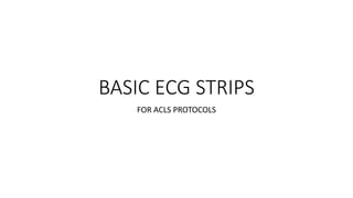 BASIC ECG STRIPS
FOR ACLS PROTOCOLS
 