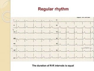 Comprehensive Introduction to Clinical Electrocardiography and ECG ...