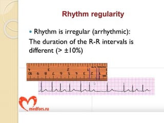 Comprehensive Introduction to Clinical Electrocardiography and ECG ...